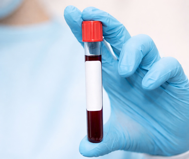 Pacchetto Benessere: CHECKUP ANEMIA