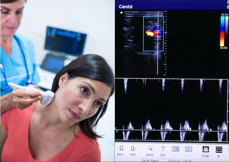 Ecocolordoppler vascolare e carotideo