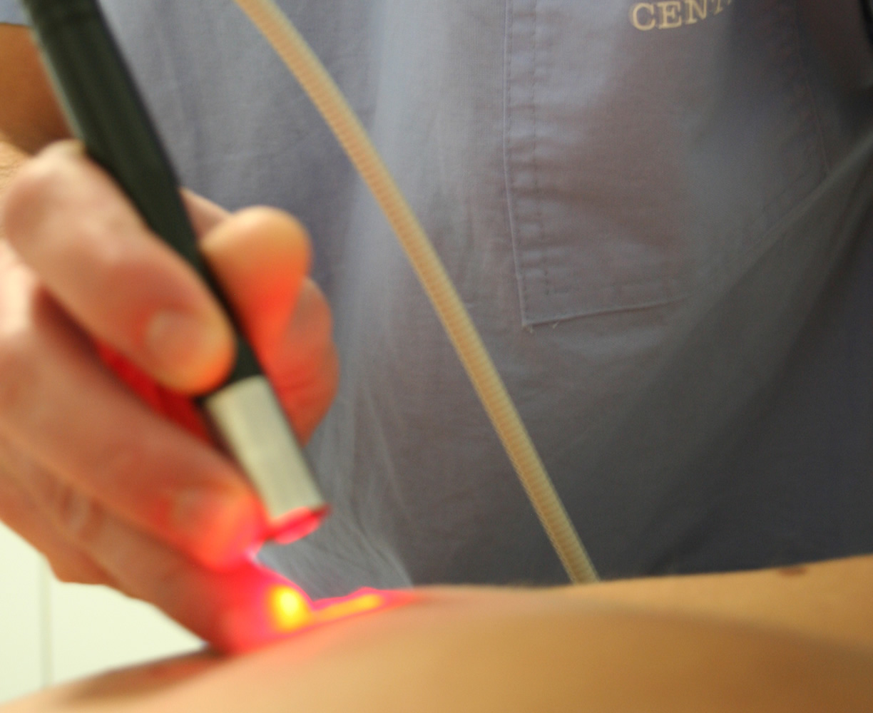 Hilterapia (laser yag)