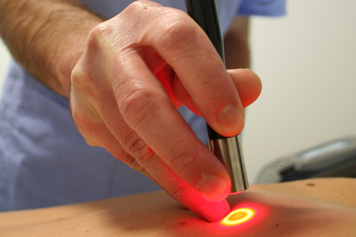 Trattamento laser ad Umbertide